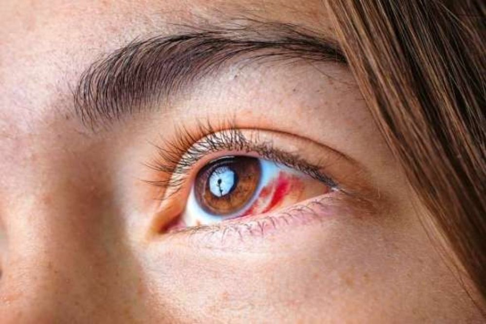 can-uv-exposure-cause-eye-cancer-the-eye-news