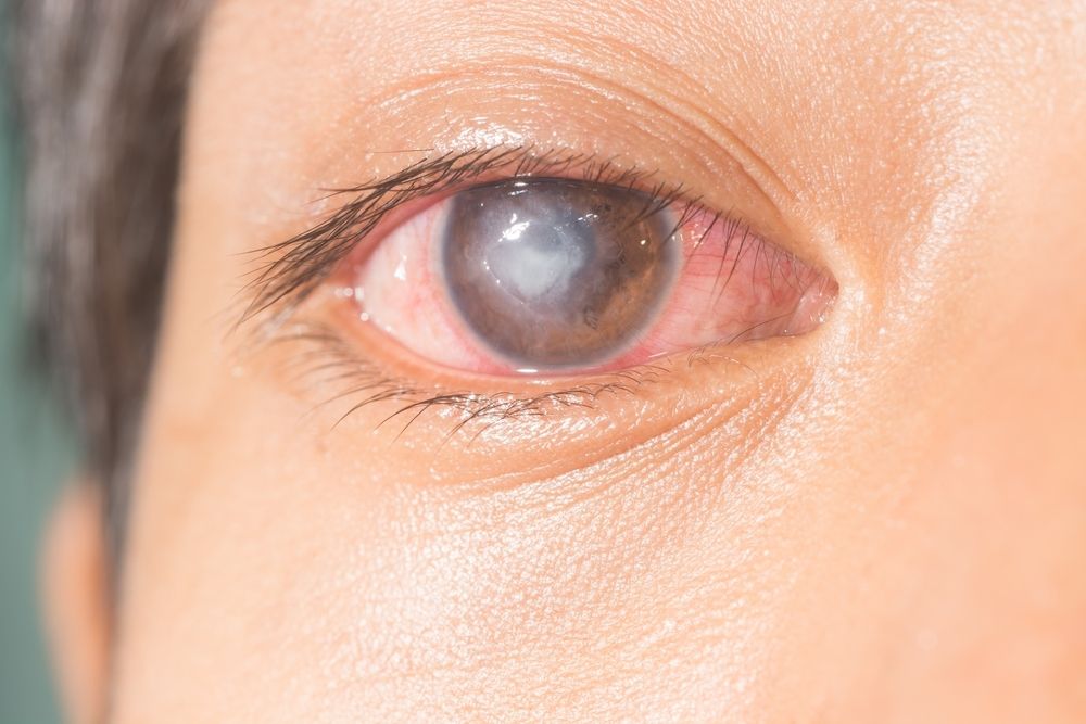 different-types-of-eye-infections-warning-signs-the-eye-news