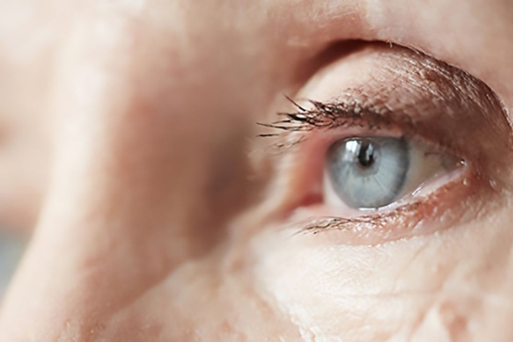 common signs that aging is changing your eyes