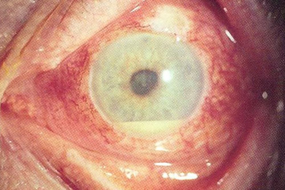 closeup of inflammed eye
