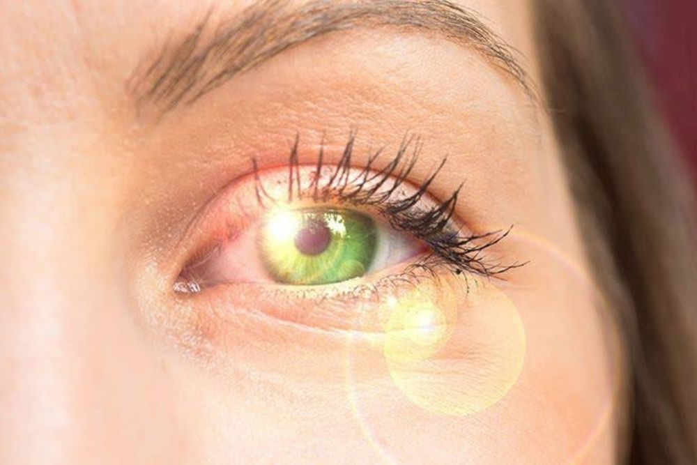 sunlight on woman's eye