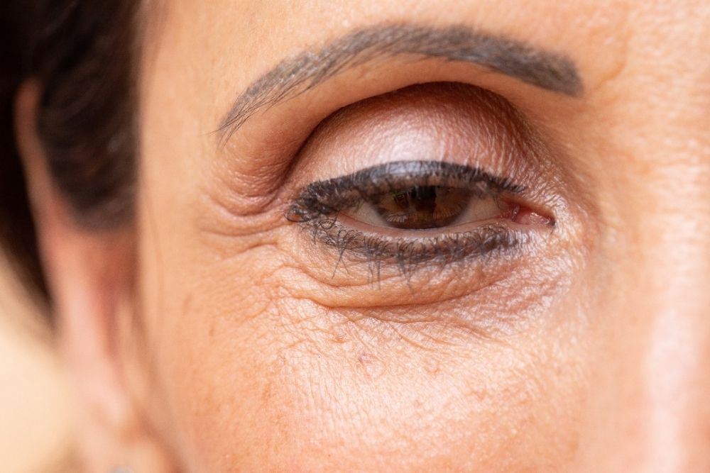 do-droopy-eyelids-affect-vision-eye-care-the-eye-news